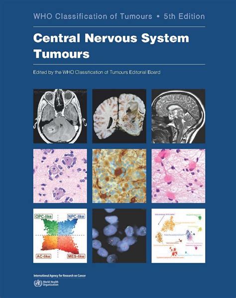 download Primary Central Nervous System Tumors